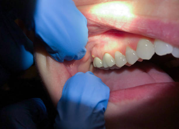 Urgent Tooth Repair in UT